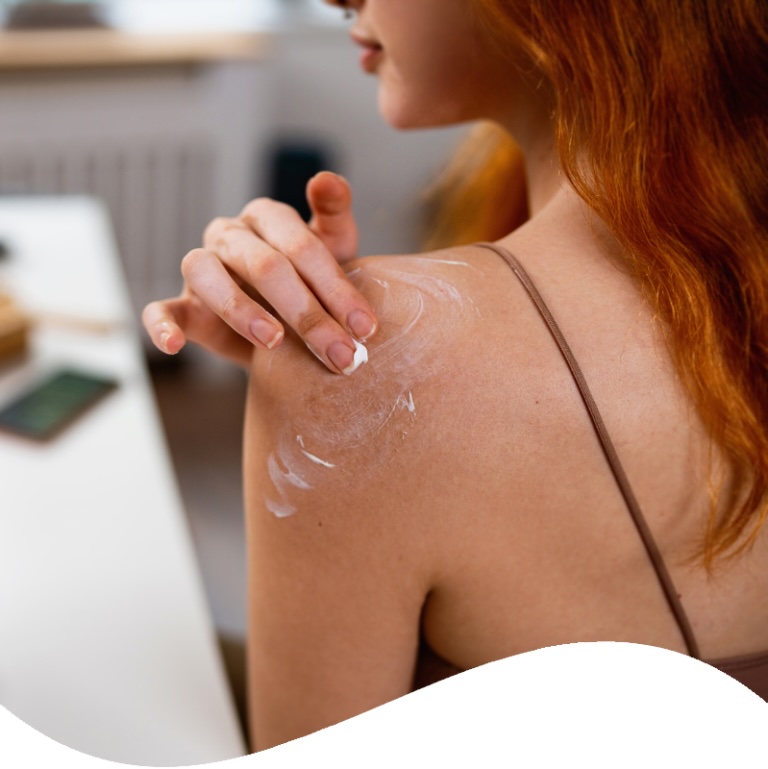 A woman applies a lotion to help her broken skin.
